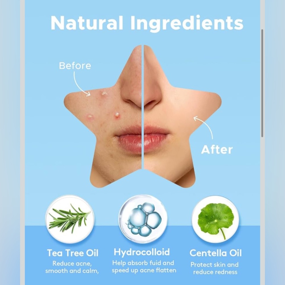 Acne Patch Set - Multicolor - Picture 3 of 8